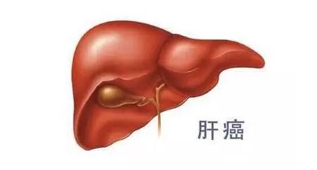 乙肝病人怎樣預防肝癌？